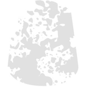 Technical : Valhallan blizzard